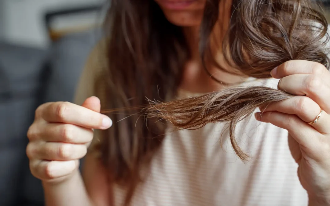 Efecto shedding tras un injerto capilar