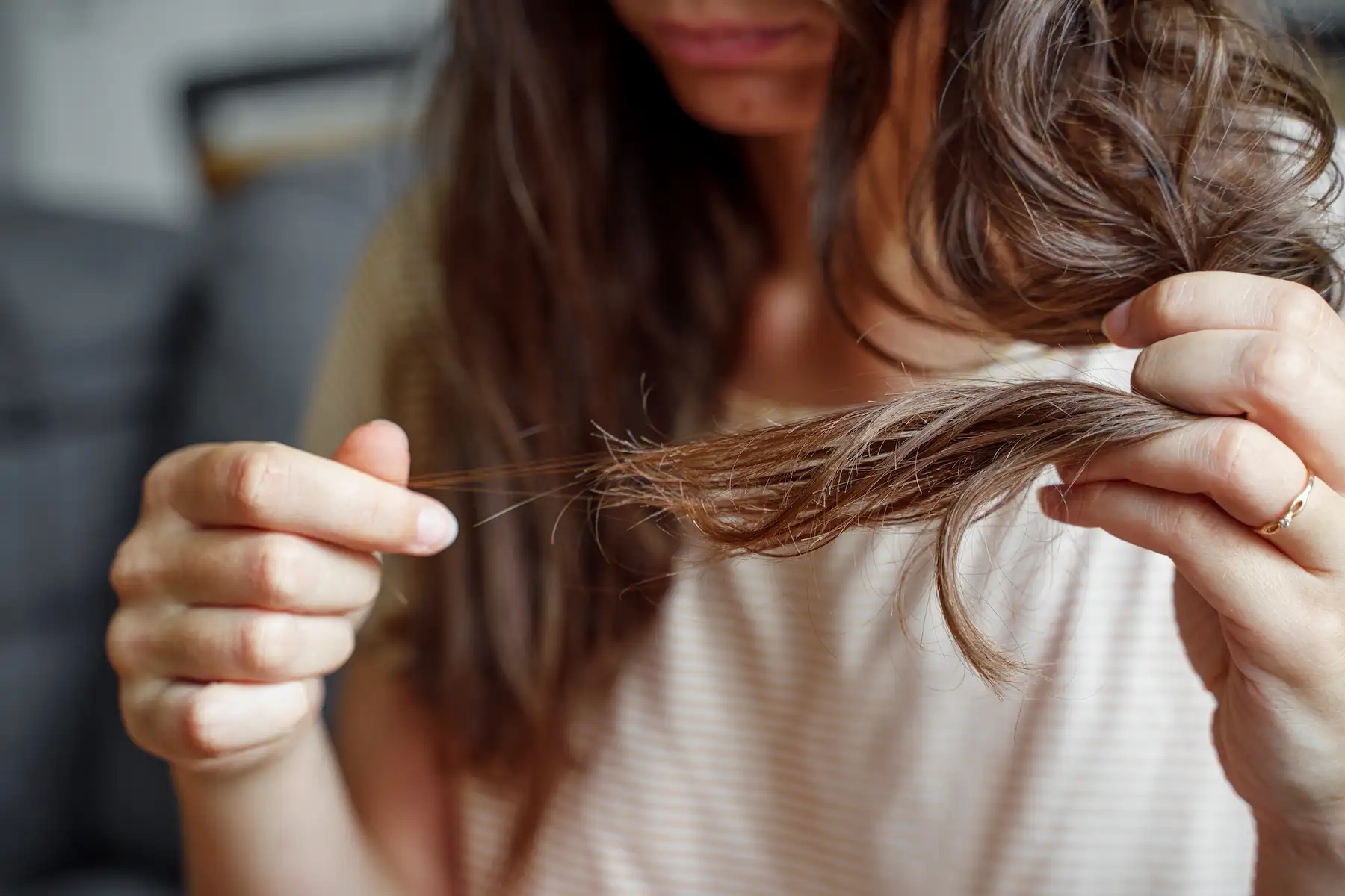efecto shedding