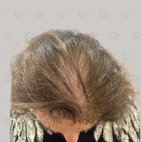 Después