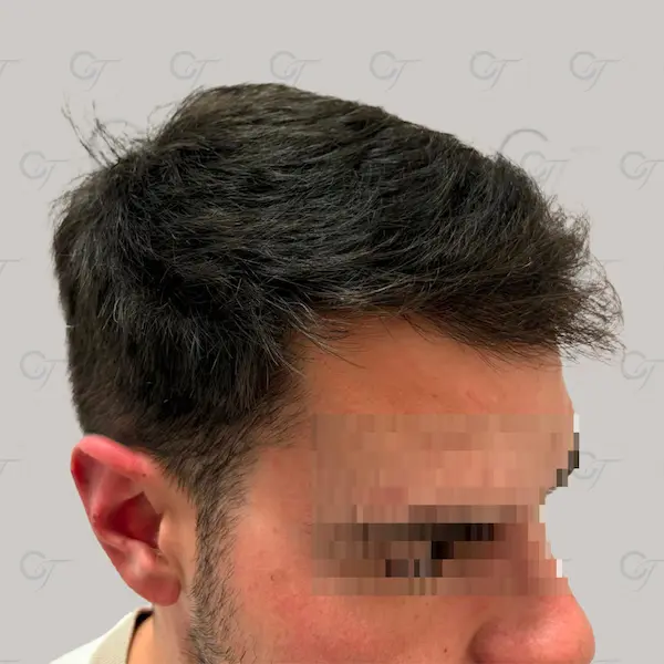 Después
