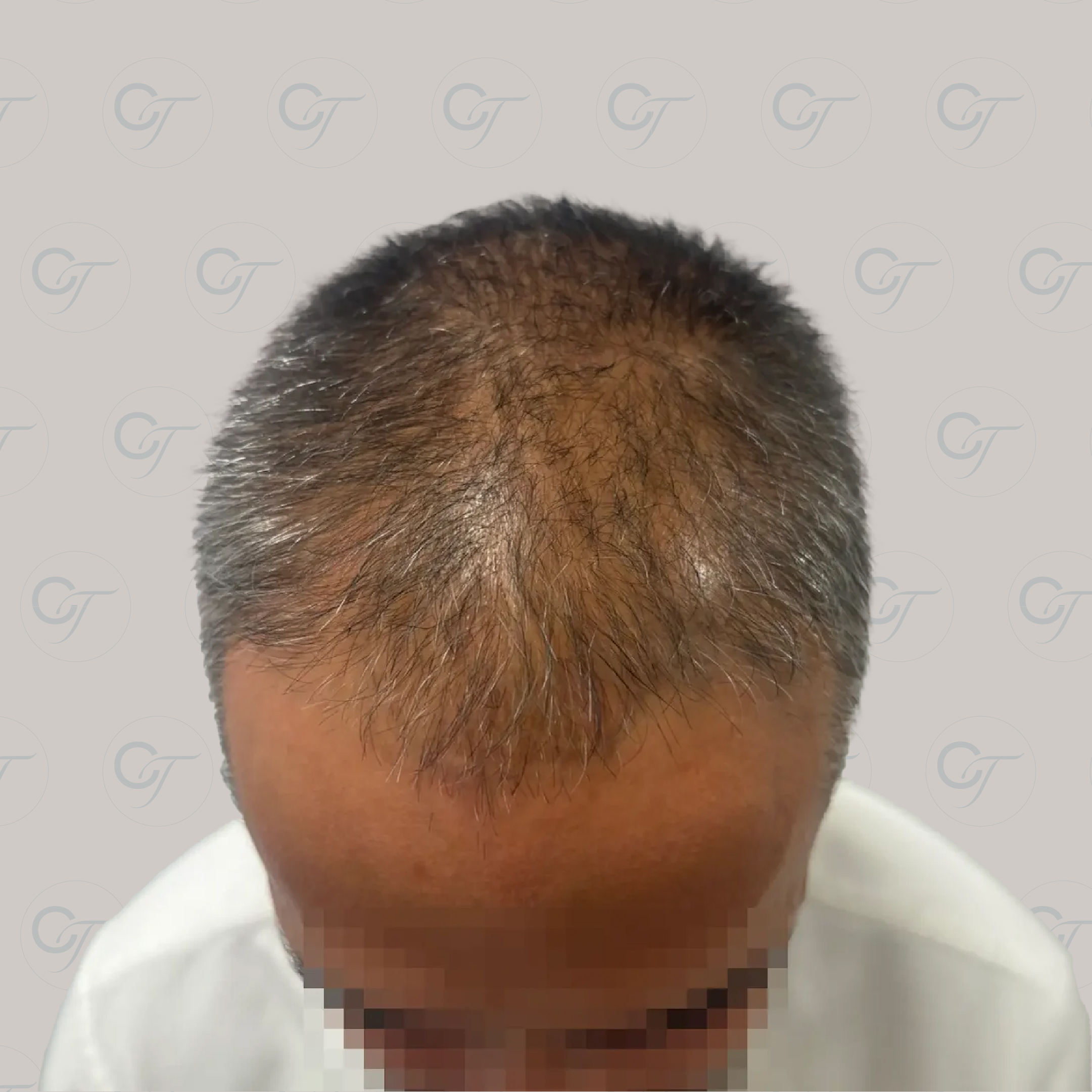Antes