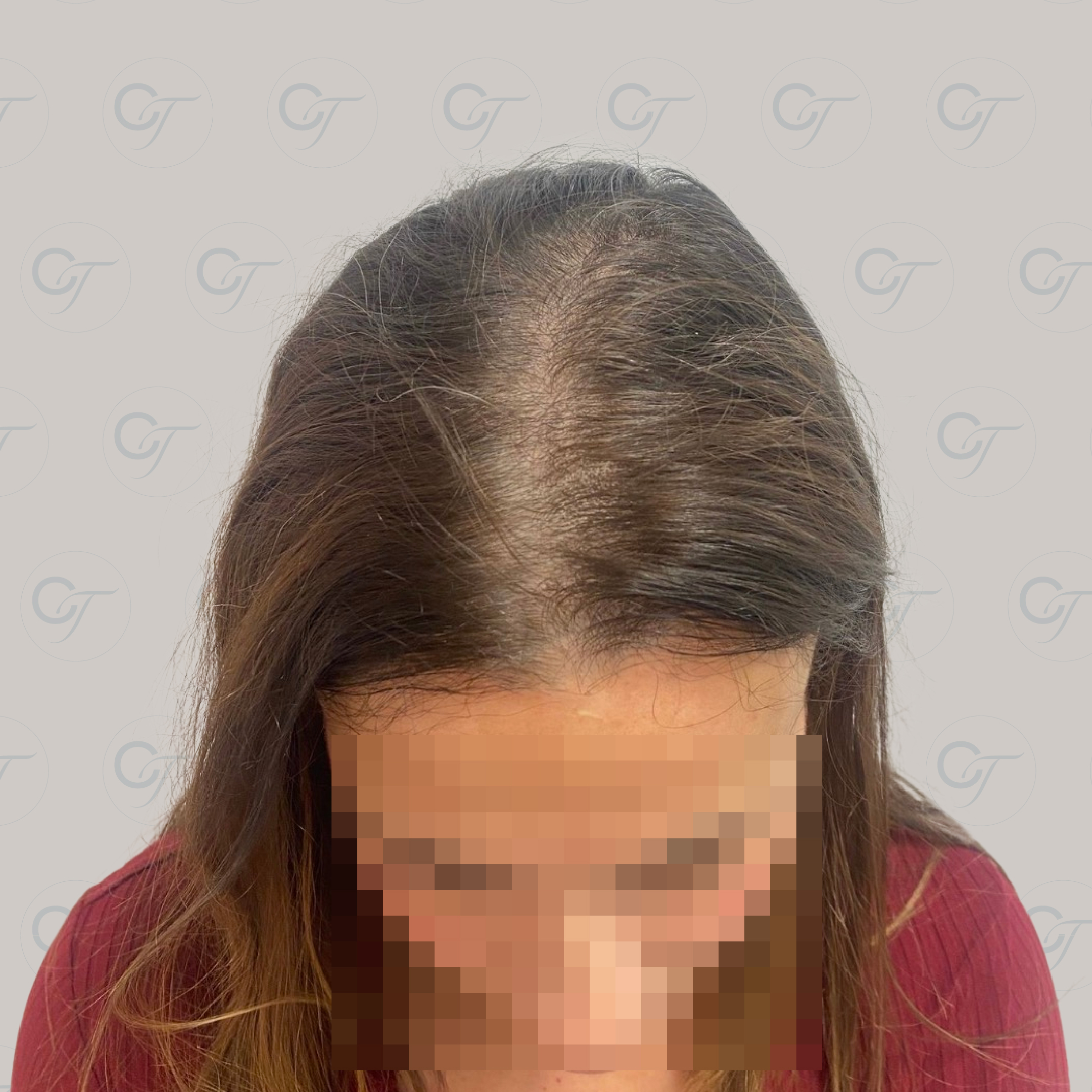 Antes