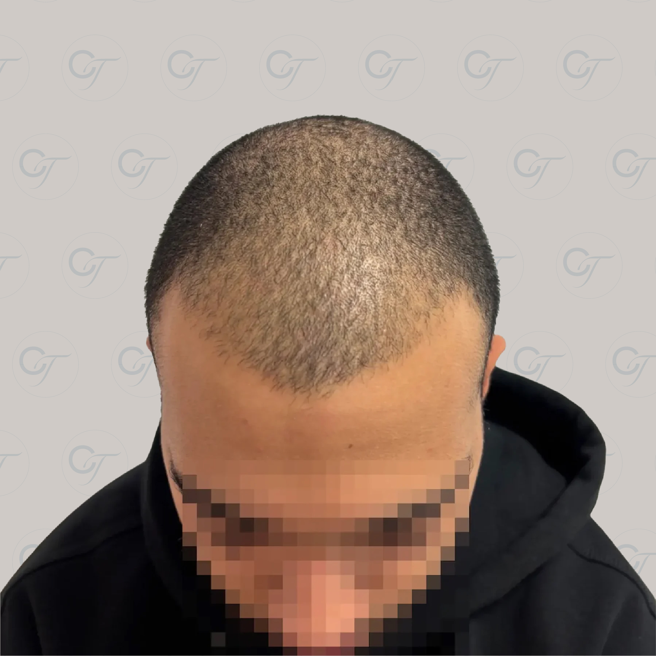 Antes
